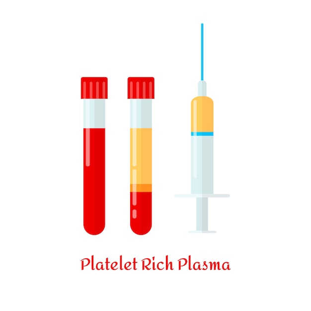 Diverse provette e siringa con sangue e plasma