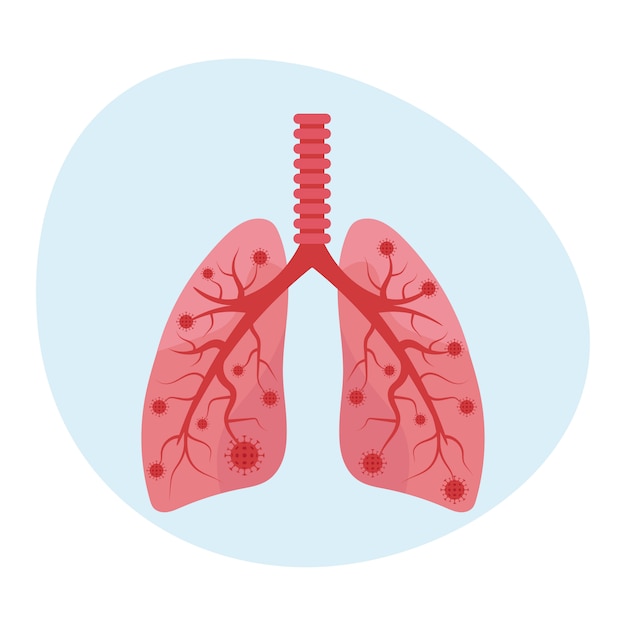 Sick lungs with covid-19 coronavirus. virus causing pneumonia. illustration in flat style