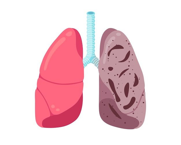 Sick unhealthy lungs tuberculosis infection disease human respiratory system internal organ tubercle