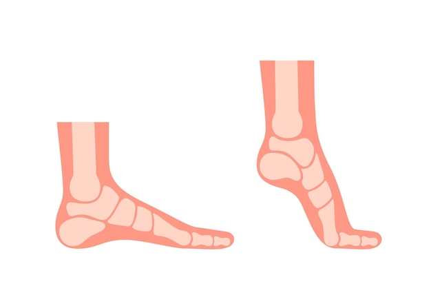 Vector silhouet menselijke voet met botten orthopedische been gezonde voeten. volle voet en tenen