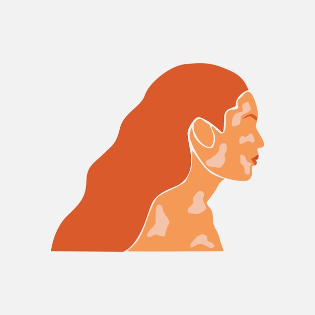 Silhouet van schoonheid roodharige vrouw met pigmentatie Wereld Vitiligo dag Diversiteitstolerantie