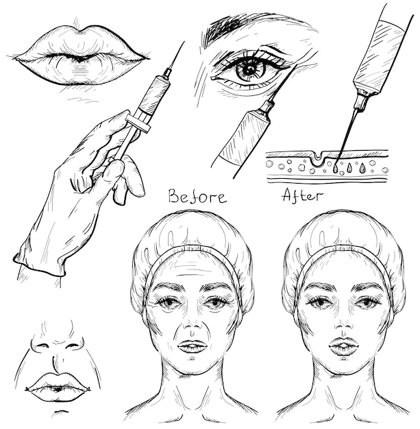 Sketch of Cosmetic surgery concept Woman facial wrinkle treatment