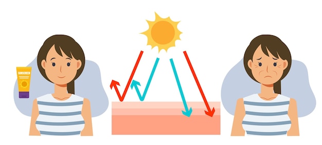 Concetti di cura della pelleprotezione solaredanni alla pelle uvcrema solareprotezione solarestrati di pelleuva uvb cartone animato vettoriale di confronto sull'utilizzo e il non utilizzo di prodotti solari