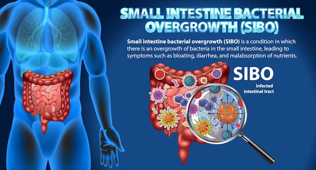 Vector small intestine bacterial overgrowth sibo