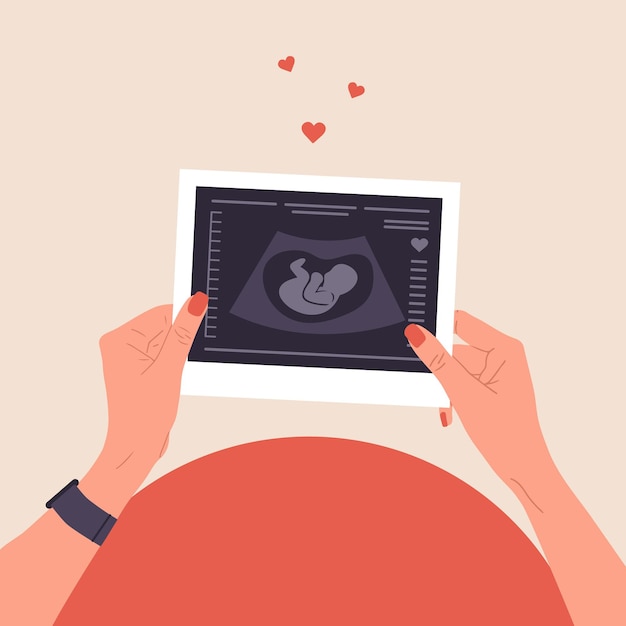 Sonografie- of ultrasonografieconcept