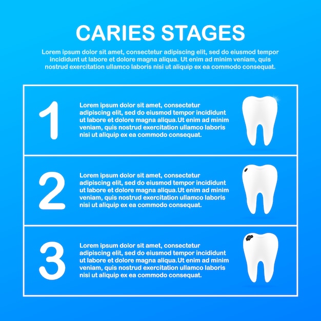 Fase di sviluppo della carie. concetto di cura dentale. denti sani.