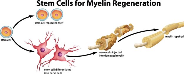 벡터 미엘린 재생을 위한 줄기세포 설명
