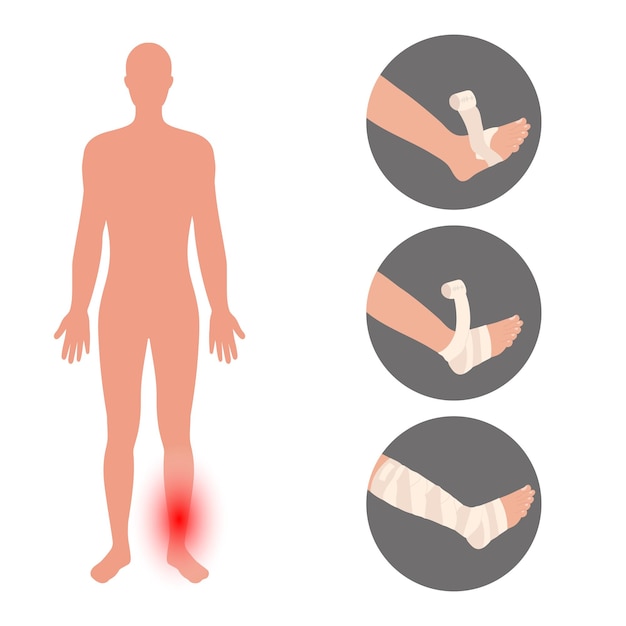 Vector steps how bandage onto leg with man schedule