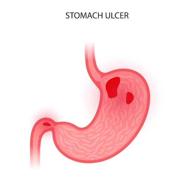 Vector stomach logo concept