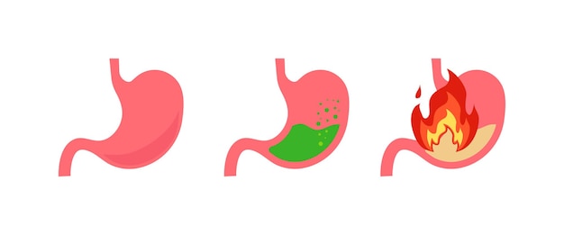 Stomach set vector for medicine isolated flat illustration