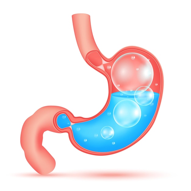 ガスと胃酸を含む胃胃の中の透明なボール