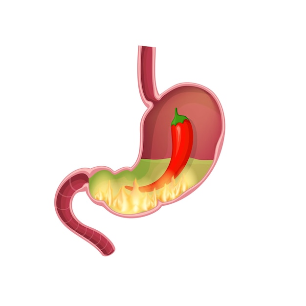 Желудок с огненным газом красного перца и желудочной кислотой