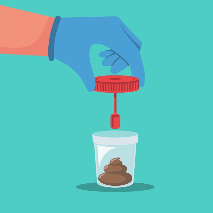Vector stool analysis the doctor in gloves holds jar with analysis laboratory container with excrement