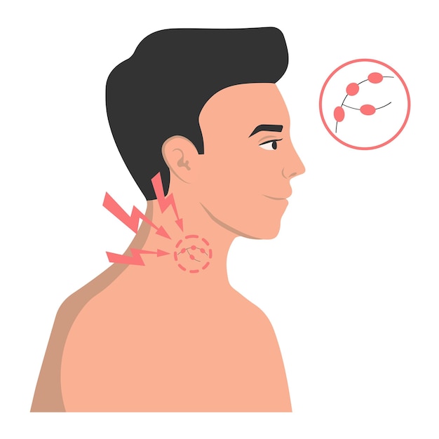 Swollen lymph nodes as a symptom of a virus flu colds vector illustration