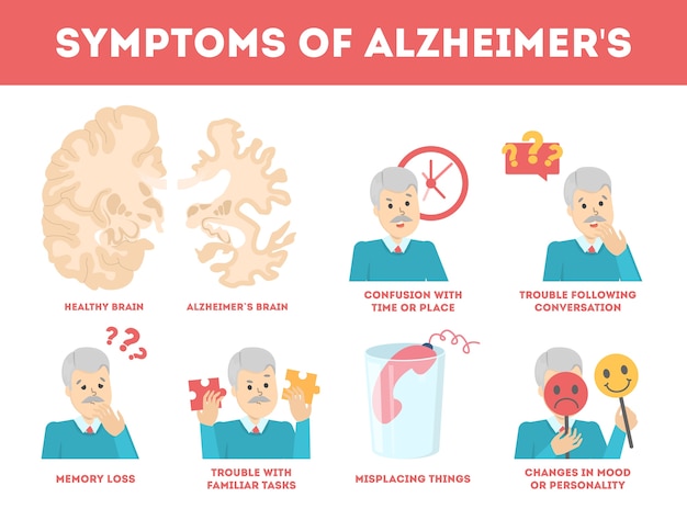 Symptomen van de ziekte van alzheimer infographic. geheugenverlies en probleem