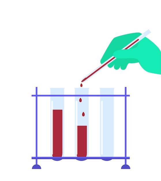 Taking blood test test tubes with biomaterial know your hiv status aids awareness