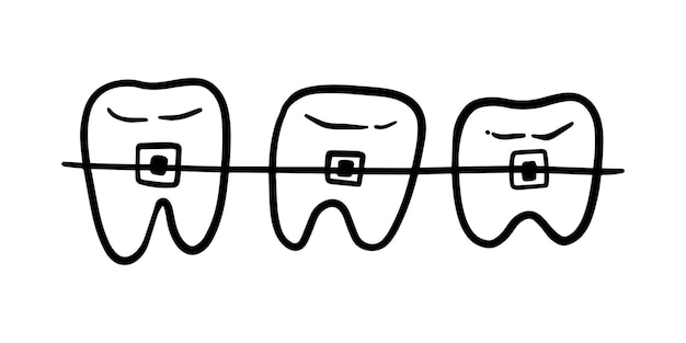 Tanden met beugels uitlijning van tanden en bijten doodle lineaire cartoon kleuren