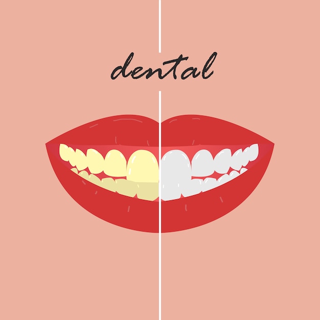 Tanden Whitening tandheelkundige kliniek