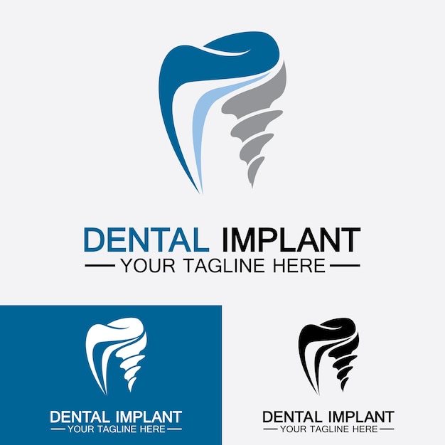 Tandheelkundig implantaat logo vector ontwerpen concept Tandheelkundige kliniek ampCare logo sjabloon