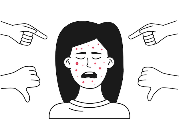 Vector a teenager with acne on her face is subjected to ridicule.