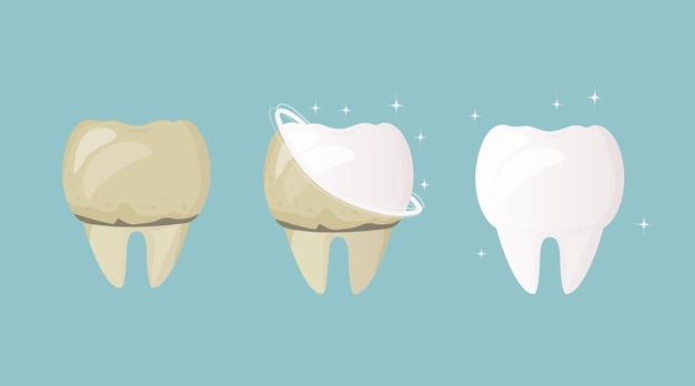 I denti sono gialli prima del trattamento e della pulizia e dopo bianchi e sani