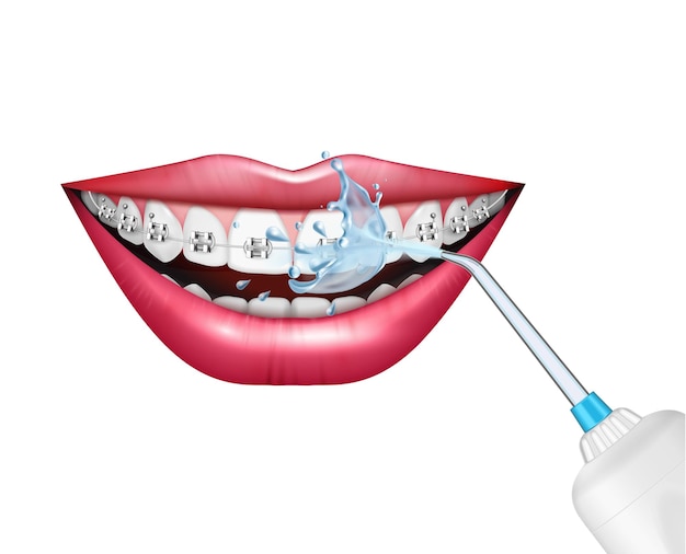 Vector teeth care oral hygiene realistic composition with dental irrigator cleaning braces vector illustration