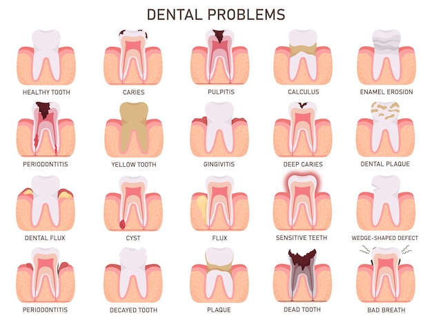 Vector teeth medical problems