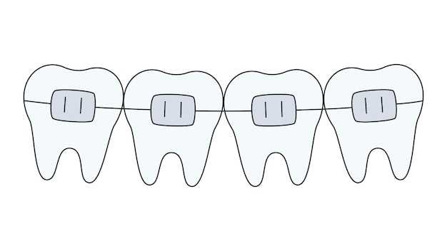 teeth row with braces