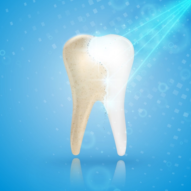 Vector teeth whitening 3d concept