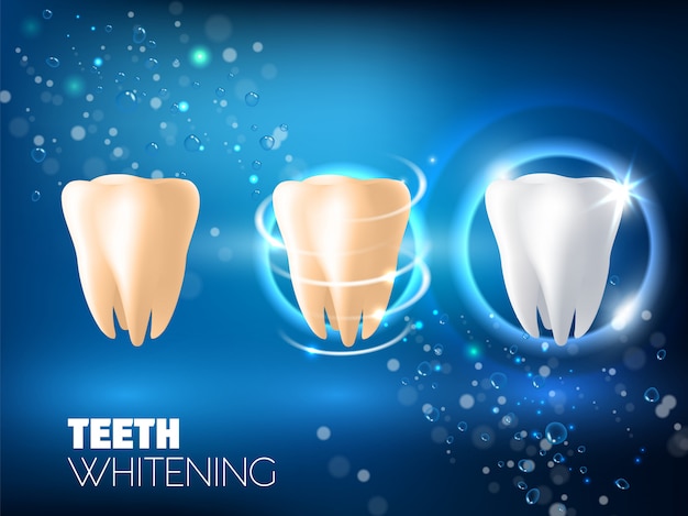 Teeth whitening ad vector realistic illustration