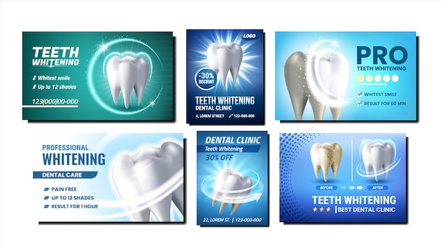 치아 미백 프로 모션 포스터 벡터를 설정합니다. 전문 치아 미백 치과 클리닉 절차 광고 배너 모음. 치과 치료 스타일 개념 템플릿 일러스트