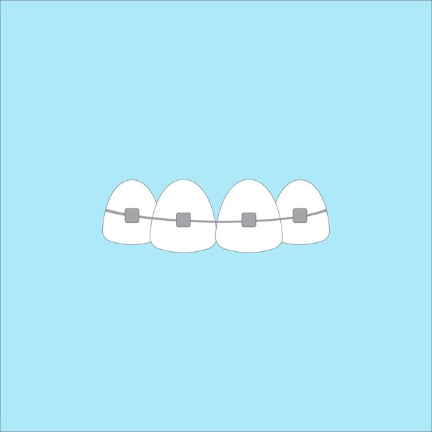 Teeth with braces on blue background Dental braces vector illustration