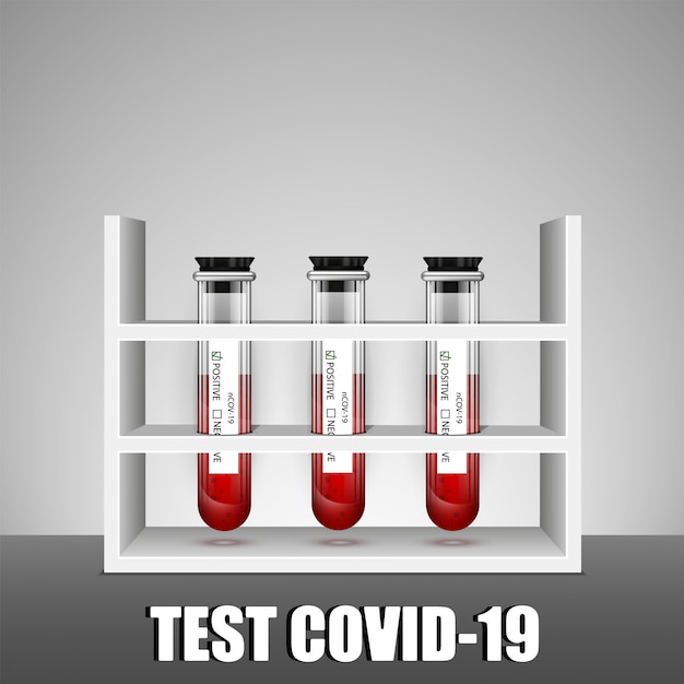 Test tube rack with coronavirus covid-19 test. illustration.