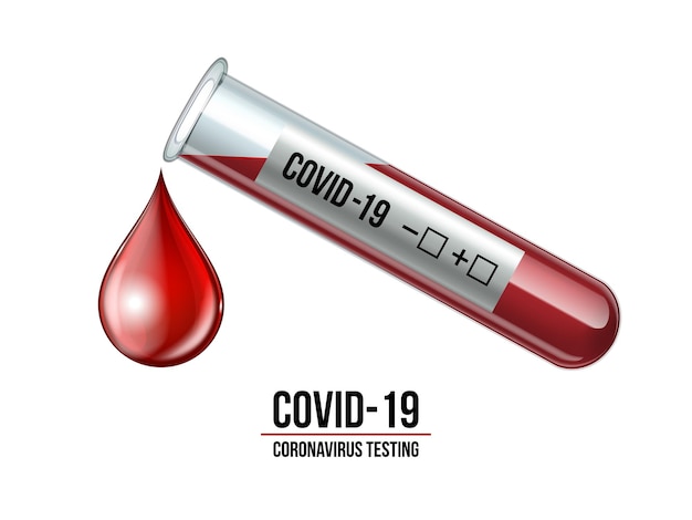 Пробирка с образцом крови для теста на коронавирус COVID19 Отрицательный результат теста на коронавирус Covid19