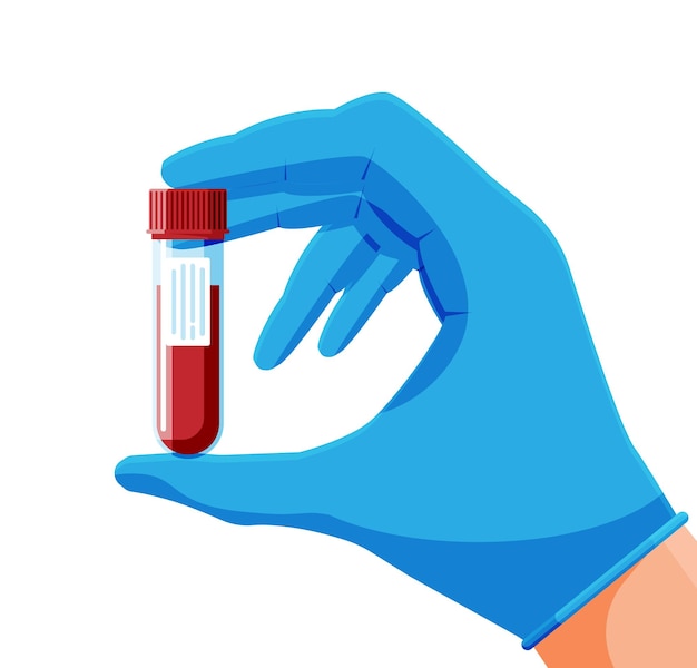 Vector test tube with blood sample in hand of doctor