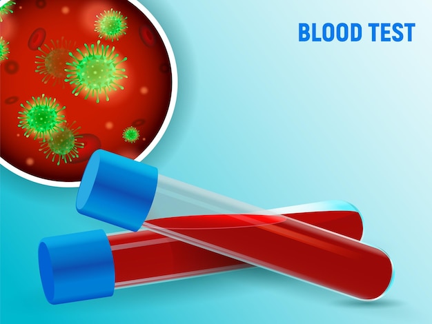 test tubes with blood for analysis positive result for the presence of the virus in the blood vector illustration