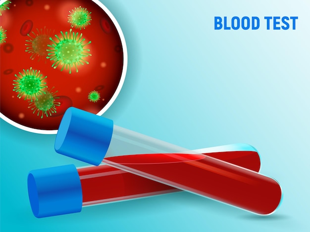 분석 을 위한 혈액 이 들어 있는 시험 튜브 혈액 에 바이러스 가 존재 한다는 긍정적 인 결과