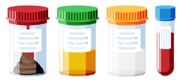 Test Tubes with Caps Stool Blood Urine Sperm