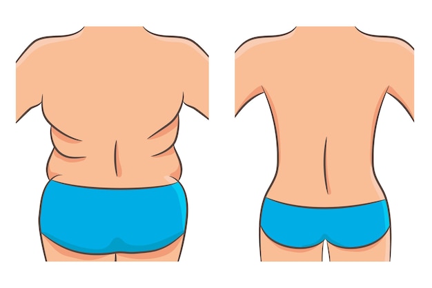 厚くて薄い、太りすぎの問題の概念。太くて細い肩、背中、腰のある女性の胴体。ダイエット、フィットネス、脂肪吸引の前後に戻ってください。分離された女性後部のベクトル図