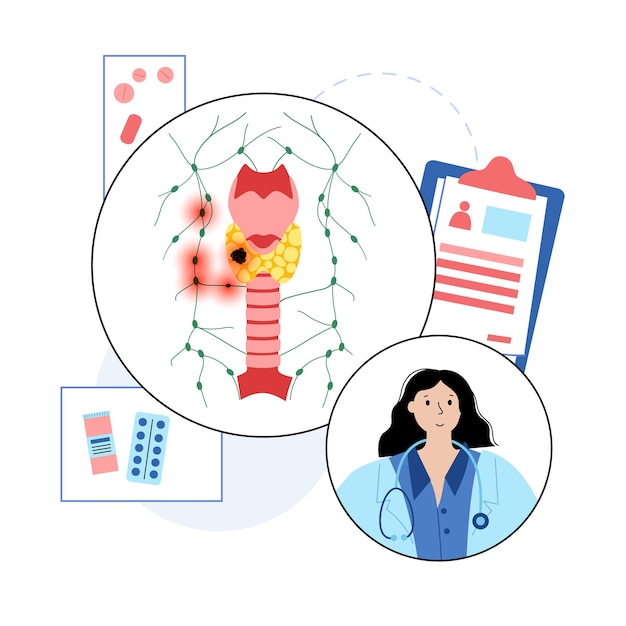 Thyroid cancer stages