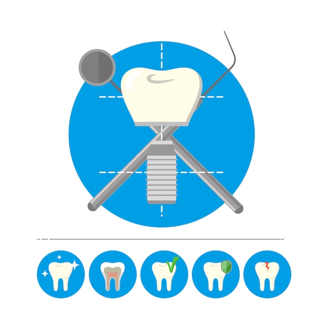 Изолированный зубной имплантат, вектор