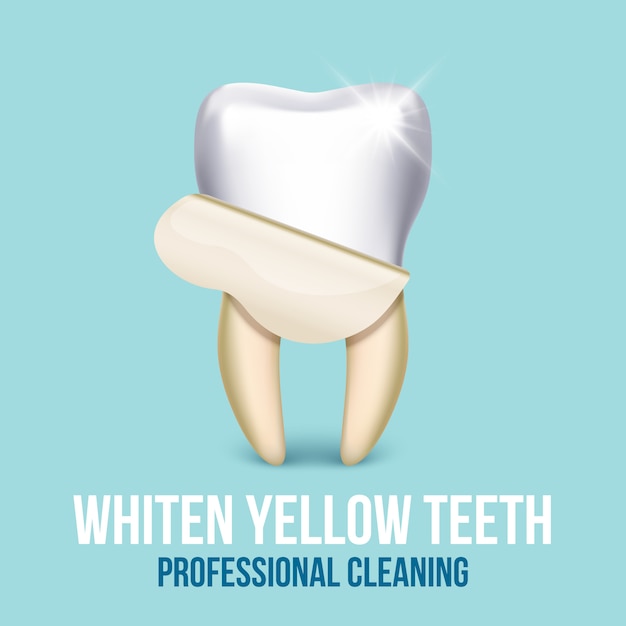 Tooth veneer whitening dental technician concept. Healthcare stomatology and cleaning profess