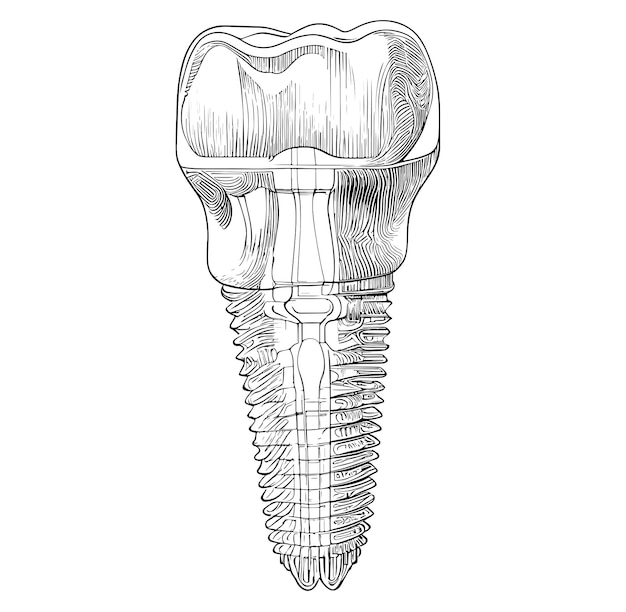 Зуб с зубом посередине