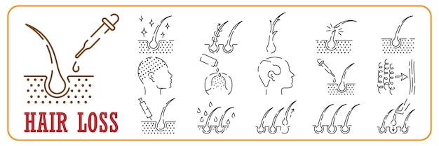 Вектор Лечение и проблема волос. набор иконок линии ухода за волосами. уход за волосами и проблема выпадения. косметические продукты для прически. иконки контуров цвета. изолированная векторная иллюстрация.