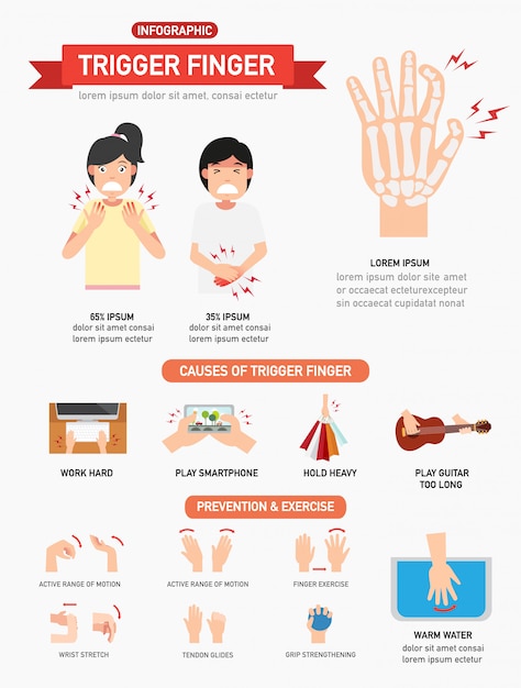 트리거 손가락 infographic, 벡터 일러스트 레이 션