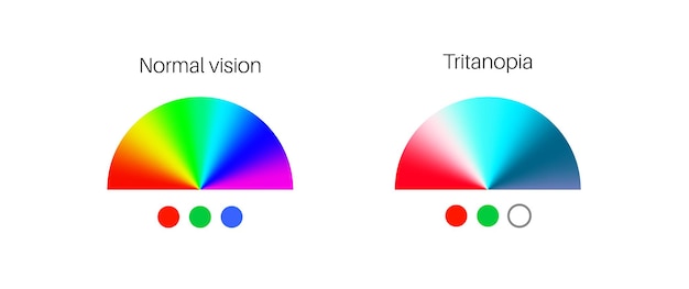 Vector tritanopia and tritanomaly