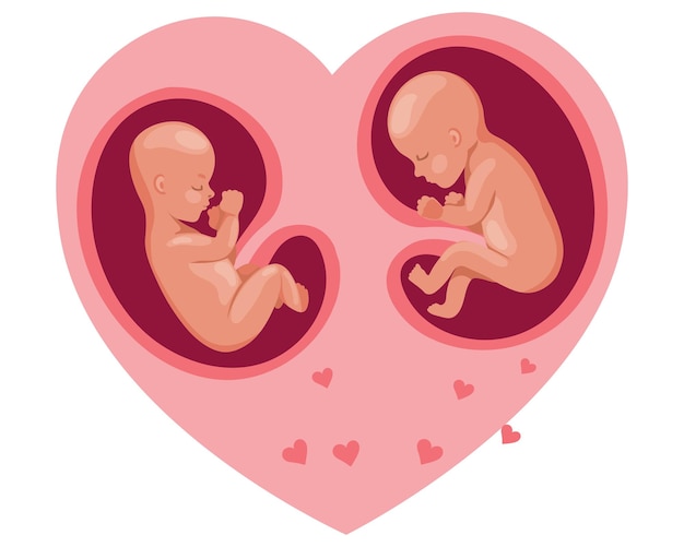 어머니의 심장에 있는 쌍둥이 배아. 임신 중 태아 발달. 일러스트레이션, 벡터