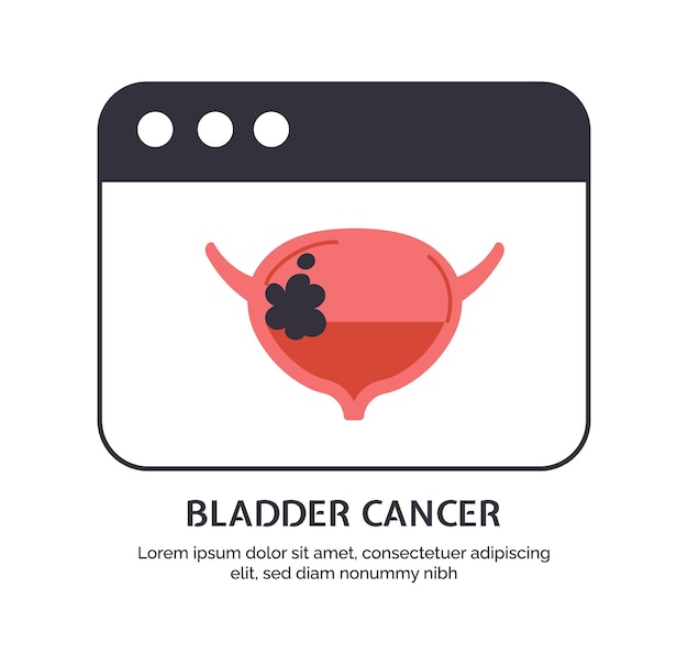 Vector type of cancer bladder vector concept