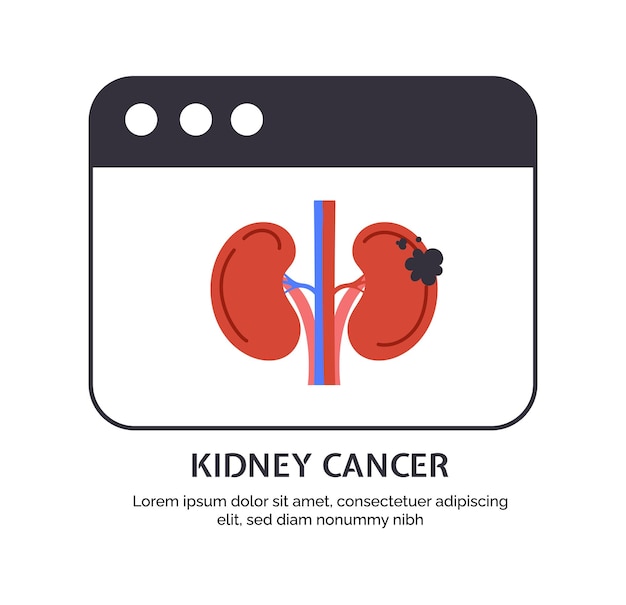 Vector type of cancer kidney vector concept