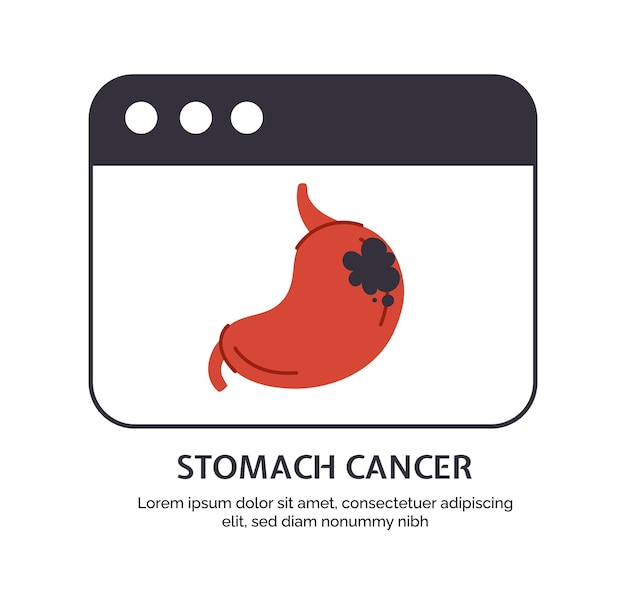 Type of cancer stomach vector concept